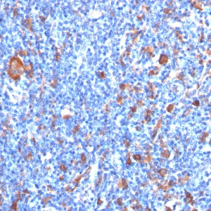 Fascin-1 (Reed-Sternberg Cell Marker); Clone FSCN1/417 (Concentrate)